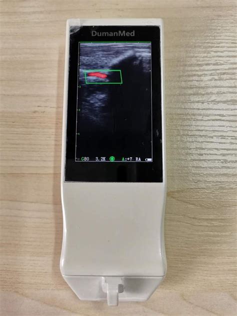 Ultrasonication Probe Handheld Ultrasound Device With Scanning Depth 60mm