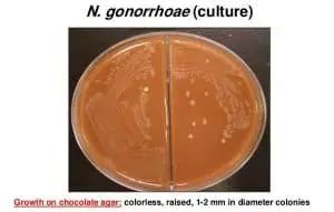 Chocolate Agar media - Preparation and Uses - Laboratoryinfo.com