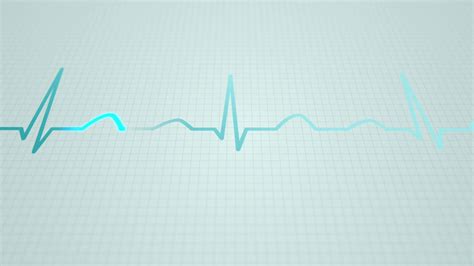 Animation Of Schematic Diagram Of Normal Stock Motion Graphics SBV-347316807 - Storyblocks