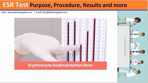 ESR Test Procedure | Lab Tests Guide