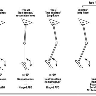 Cerebral Palsy Gait Pattern