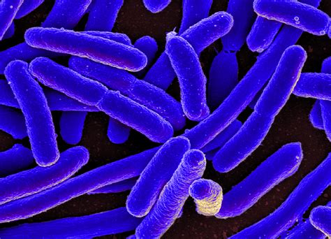 File:E. coli Bacteria (16578744517).jpg - Wikimedia Commons