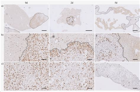 Ki67 (proliferation marker) immunohistochemistry staining on 300 µm ...