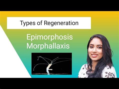 Types of Regeneration | Epimorphosis and Morphallaxis - YouTube