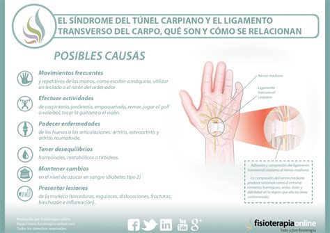 Sindrome Del Tunel Carpiano Causas Sintomas Y Tratamiento – NBKomputer