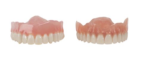 3D Printed Digital Dentures - Silcox Dental Supply