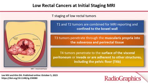 Low Rectal Cancers at Initial Staging MRI | RadioGraphics