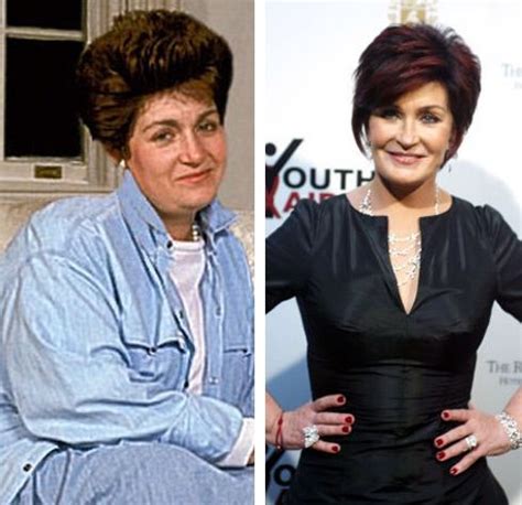 Sharon Osbourne before and after plastic surgery (2) | Celebrity ...