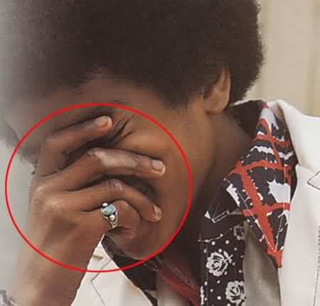 || The Vitiligo Proof || - Michael Jackson Photo (32272045) - Fanpop