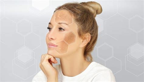 Skin Discoloration: Common Causes and Solutions · Conway Medical Center