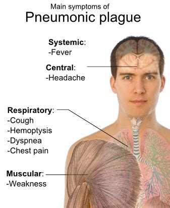 File:Symptoms of pneumonic plague.png - Wikimedia Commons