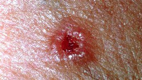 Discolored Skin Patches: Pictures, Causes, and Treatments