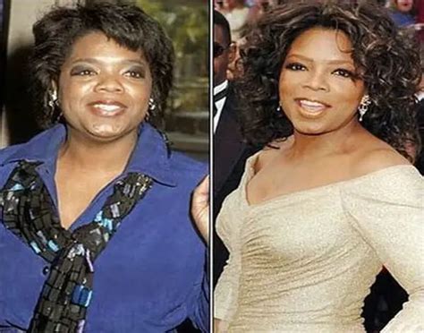 Oprah Winfrey Plastic Surgery Before and After | Celebie