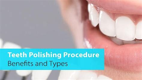 Teeth Polishing Procedure: Benefits and Types