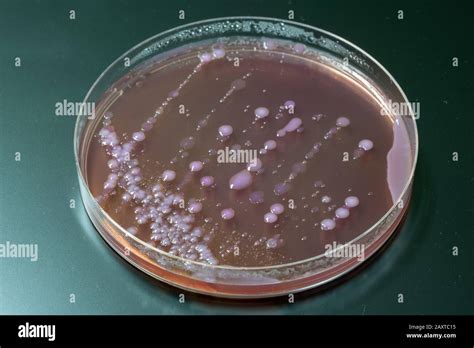 bacterial colonies on agar medium petri dish plate plate with MacConkey ...