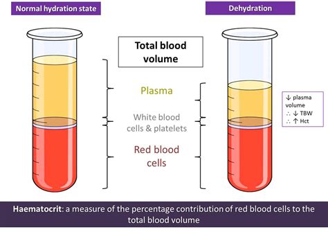 What Can A Low Hematocrit Level Indicate - Peter Brown Bruidstaart