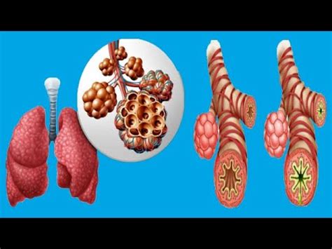 Bronchospasm: Causes And Symptoms - YouTube