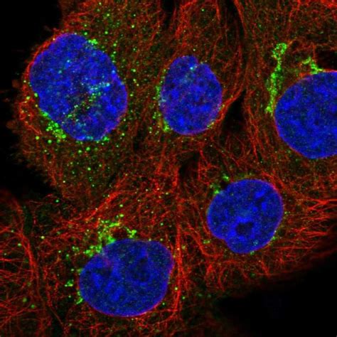 CD59 Antibody (PA5-82921)