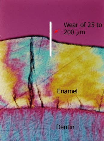 Depth of enamel removal. Polarized light microscopy showing the ground... | Download Scientific ...