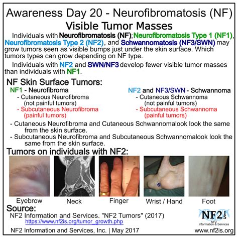 Skin Surface Tumors | Awareness, Neurofibromatosis type 1, Nursing ...