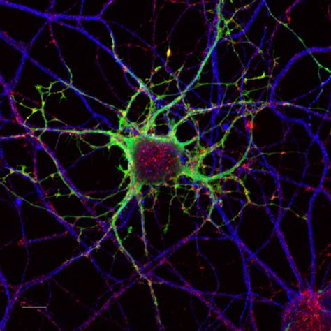 Neurons, confocal fluorescence microscopy | Primary neuronal… | Flickr