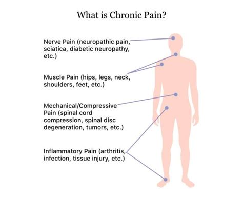 Chronic Pain Syndrome | Indication, Causes, & How To Diagnose It