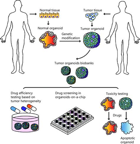 Organoids in cancer research and personalized medicine. Tumor organoid... | Download Scientific ...