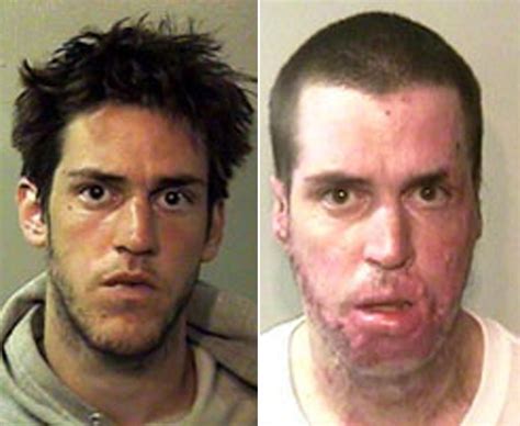 Shocking before and after pics of crystal meth junkies | Weird pictures and photo galleries ...