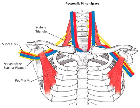 Diagnostics | Free Full-Text | Pectoralis Minor Syndrome: Subclavicular Brachial Plexus Compression