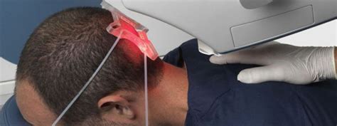 Robotic Hair Transplant - Things To Know | Hair Transplant Dubai