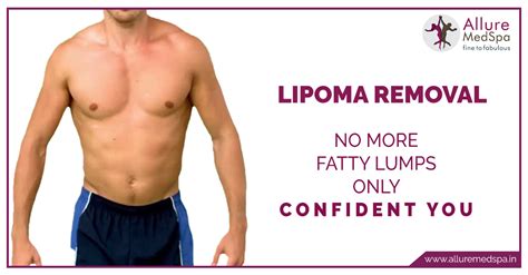 Multiple Lipoma Removal Surgery at Affordable Cost in Mumbai