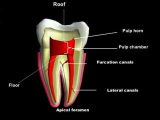 Anatomy of the pulp space and access cavity | PPT