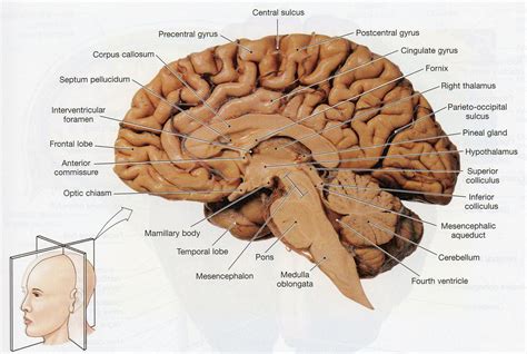 Interthalamic Adhesion Sheep Brain