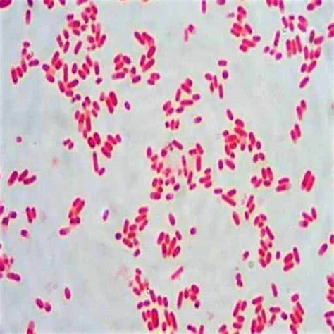 Escherichia Coli Gram Stain Escherichia Coli And Bacillus Sp 70200 | The Best Porn Website