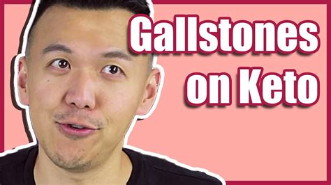 DISCOVERED GALLSTONES ON KETO DIET - YouTube