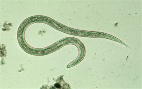 CDC - DPDx - Intestinal Hookworm