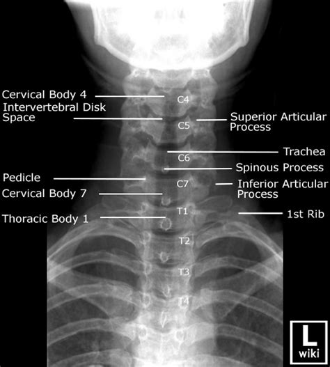 Pin on anatomy