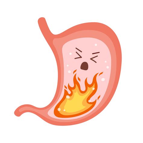 Human stomach. Heartburn, gastritis and acid reflux, indigestion ...