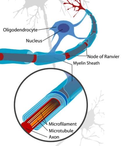 Small Fiber Neuropathy: Definition, Diagnosis, and Treatment ...