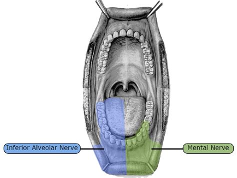 Nerve Blocks of the Face and Mouth — Downeast Emergency Medicine