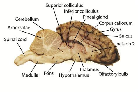 A virtual sheep brain dissection guides anatomy studies with photos ...