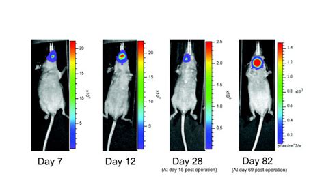 Bioluminescence imaging of mice orthotopically transplanted with ...