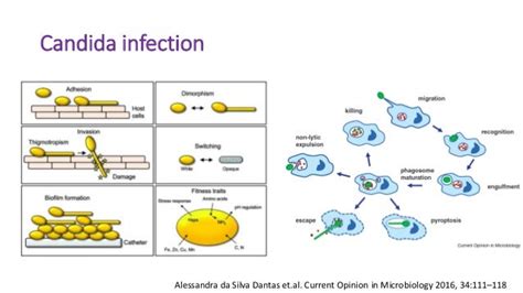 Chronic mucocutaneous candidiasis