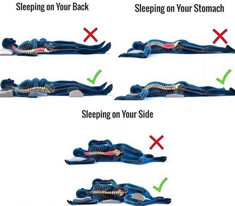 How To Sleep With Back Pain - All Star Chiropractic