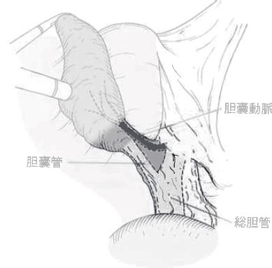 Shape of Serosa and adhesion 13? | Download Scientific Diagram