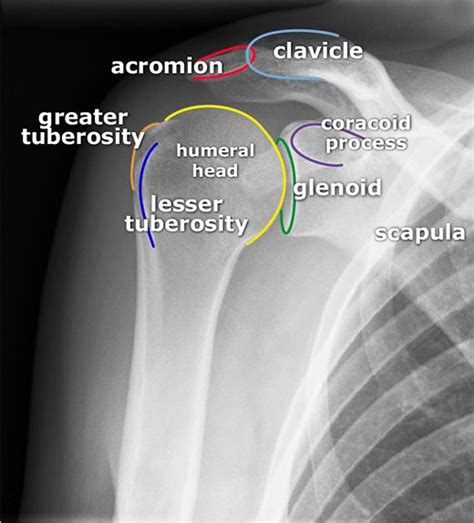 glenoid | Radiology student, Human anatomy and physiology, Medical anatomy