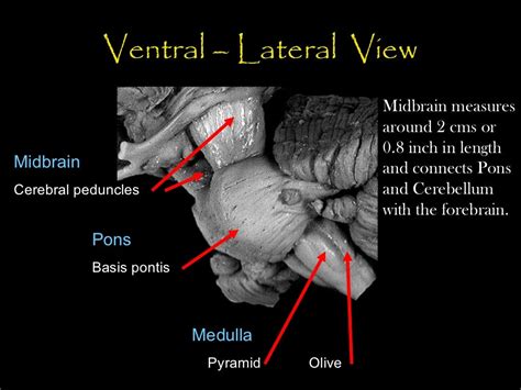 MIDBRAIN ANATOMY