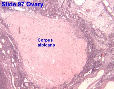 Corpus albicans - Wikipedia