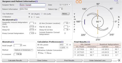 A Direct Method for Determining Toricity Ratios of Toric Intraocular Lens Calculators ...