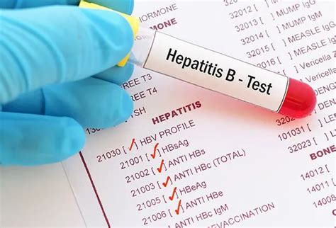 What Is the Normal Range for Hepatitis B Surface Antibody?